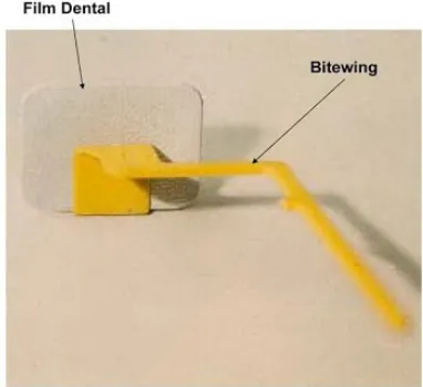 Gambar film dental
