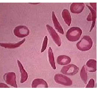 Gambar 4.9. Sickle Cell citra ke-2 