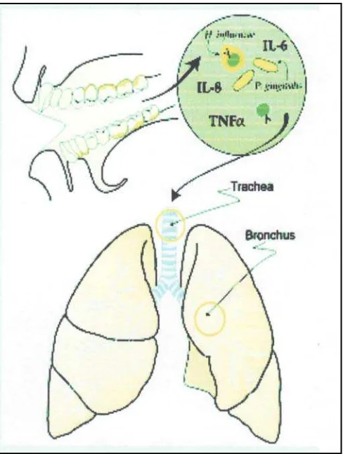 Gambar. 2 Mekanisme terjadinya infeksi saluran pernafasan      (Scannapieco FA.J Periodontol 1999;70:795) 