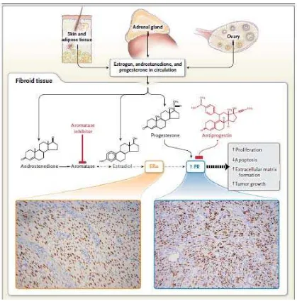 Gambar 4. Efek biologis dari estrogen dan progesteron pada jaringan mioma (dikutip dari 2) 