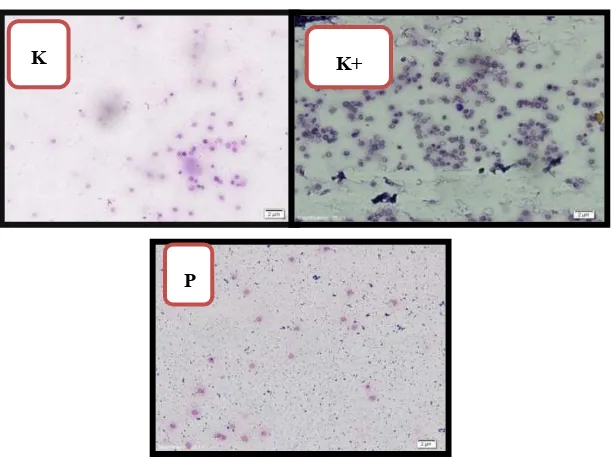 Gambar 1. Preparat Apusan Cairan Cereborspinal (CSS) Dari Kelompok Sehat (K), Kelompok Injeksi LPS (K+), dan Tikus Terapi Dengan ACTH (P) pada perbesaran 200x
