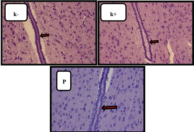 Gambar 2. Histologi Sel Endotel Mikrovasculer Jaringan Otak Tikus Sehat (K-), Tikus Yang Mendapat Injek LPS (K+), dan Otak Tikus Pasca Terapi ACTH (P)