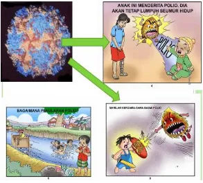 Gambar 9. Gambaran Penyakit Polio[12] 