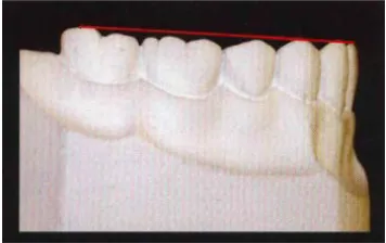 Gambar  10. Oklusi normal20 