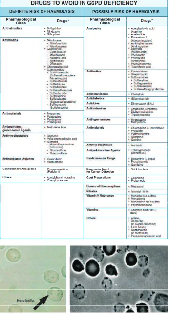 Tabel 1 Obat-obatan yang dapat mencetuskan hemolisis pada G6PD11