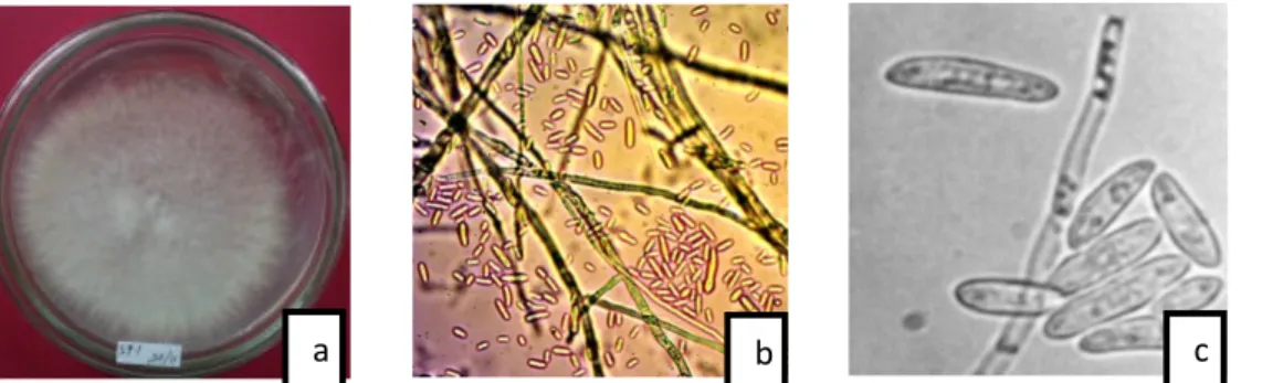 Gambar 6. Genus Fusarium, (a) Makroskopis, (b) Mikroskopis (Perbesaran 400x), dan (c) Gambar literatur (Watanabe, 2010)