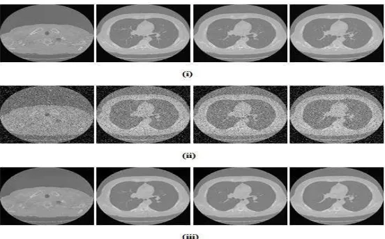 Figure 1 : Images for (i) Sample Input of CT-Scan Image (ii) Gaussian Noise Added Image (iii) Gaussian Noise Removed Image 