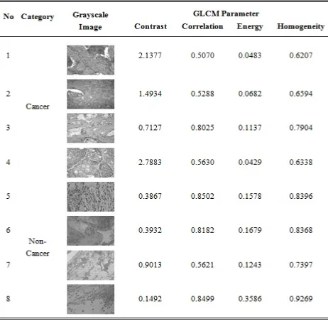 Table 1. Samples extracted features from microscopic lung biopsy images. 