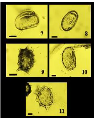 Gambar 1. Morfologi spora paku epifit di kawasan Universitas  Riau; 1.  Asplenium nidus, 2