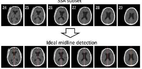 Figure 9. The results of the SSA algorithm (the upper fig-ures) and the ideal midline detection (the lower figures)