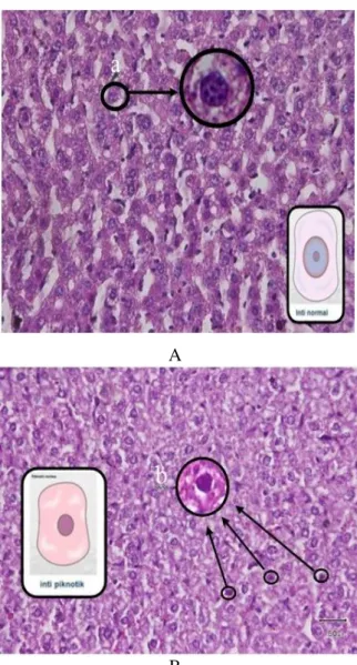 Gambar    6.  (A)  Histologi  Hepar  Pada 