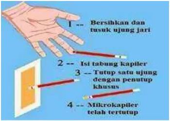 Gambar 8. Tabung Wintrobe ( hematokrit makro )