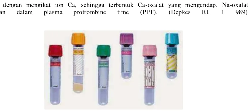 Gambar 9. Macam macam Tabung antikoagulan http://hendrosmk.files.wordpress.com/2011/08/vacuum-blood-collection-tubes.jpg