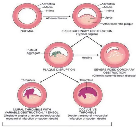 Gambar 4.1. Proses Trombosis di Pembuluh Darah