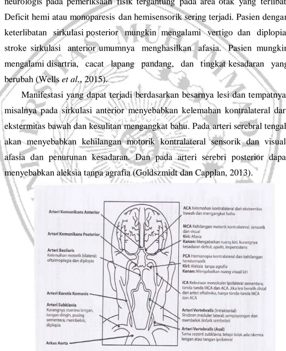 Gambar 2. 8 Gambaran klinis sindrom stroke   (Goldszmidt and Caplan, 2013) 