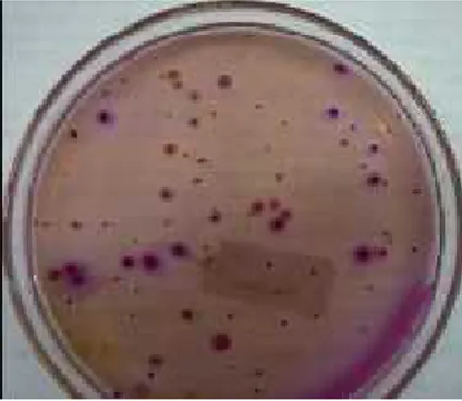 Gambar 2. Morphologi koloni bakteri Coliform pada media Violet Red Bile