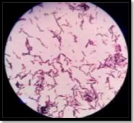Gambar  1.  Bakteri  asam  laktat  yang  ber-Gram  positif  dan  berbentuk  basil  atau  batang  yang  diamati  pada  mikroskop  binokular  dengan  perbesaran  100x