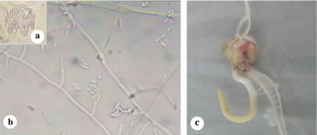 Gambar  3.  Bentuk  makrokonidia  (a)  dan  mikrokonidia  dari Fusarium  moniliforme  (b)  serta  gejala serangan F