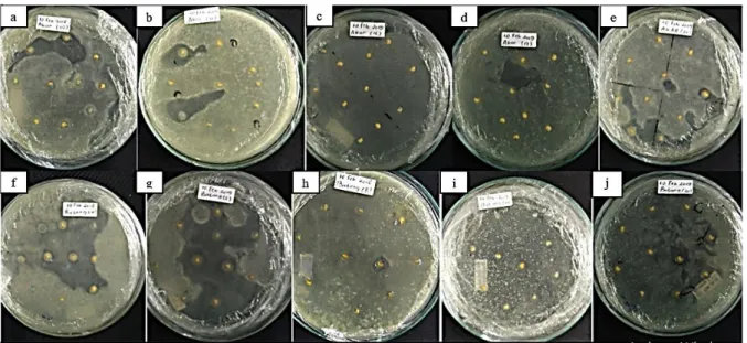 Gambar 2. Uji antagonisme isolat bakteri endofit dengan R. solanacearum. (a) A3E10, (b) A3E11,  (c) A4E16, (d) A5E17, (e) A5E20, (f) B1E4, (g) B2E5, (h) B2E8, (i) B4E14, (j) B5E20  Kemampuan  bakteri  endofit  dalam  menghambat  R