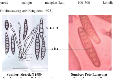 Gambar 1. Jamur Helminthosporium turcicum (Pass.) Leonard et Suggs. 