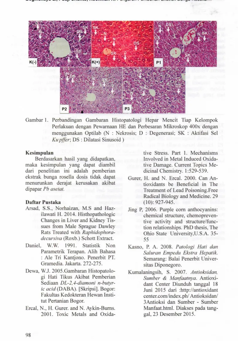 Gambar 1 .  Perbandingan  Gambaran  Histopatologi  Hepar  Mencit  Tiap  Kelompok  Perlakuan  dengan  Pewarnaan  HE  dan  Perbesaran  Mikroskop  400x  dengan  menggunakan  Optilab  (N  :  Nekrosis ;  D  :  Degenerasi ;  SK  :  Aktifasi  Sel  K u pffer ;  DS