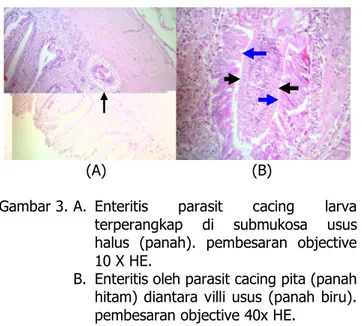 Gambar 3. A.  Enteritis  parasit  cacing  larva 
