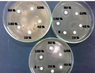Gambar 1 Cawan petri yang sudah diinkubasi selama  1  x  24  jam,  kemudian  dilihat  zona  hambatnya  dan  diukur  menggunakan  jangka  sorong,  lalu  diameter  zona hambat dihitung dan dimasukkan dalam tabel  pengamatan