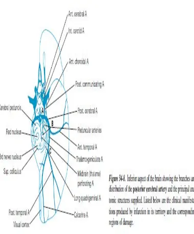 Gambar 4: Territori posterior Cerebral Artery 