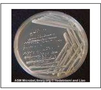 Gambar 5. Streptococcus mutans pada                    pewarnaan gram20 