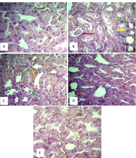 Gambar  1.  Fotomikrograf  ginjal  tikus  (hematoksilin  dan  eosin,  400x)  dari  (A)  kelompok  kontrol  menunjukkan  histologi  ginjal  normal;  (B)  kelompok  induksi  APAP  menunjukkan  adanya  nekrosis  sel  (panah  kuning),  dilatasi  tubulus  (pana