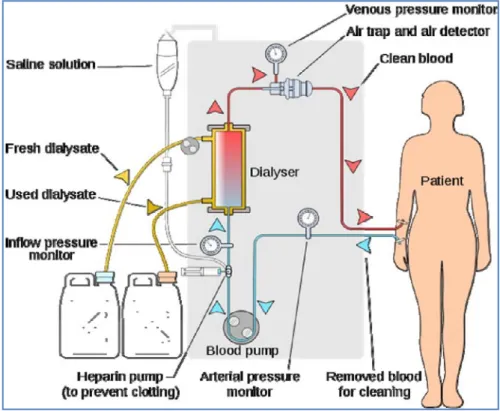 Gambar 8. Proses hemodialisis 