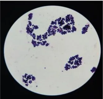 Gambar 1. Pewarnaan gram bakteri 