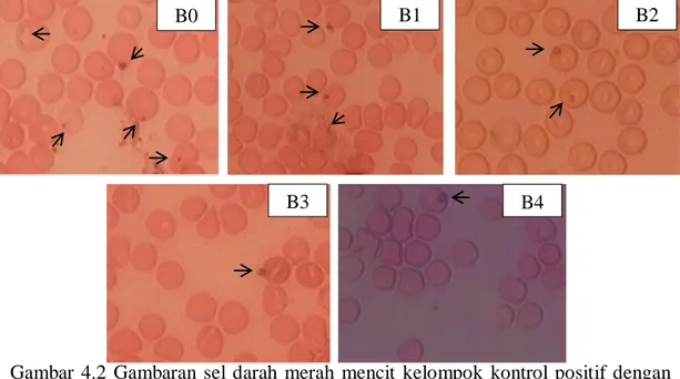 Gambar  4.2  Gambaran  sel  darah  merah  mencit  kelompok  kontrol  positif  dengan  pemberian  klorokuin  dosis  5,71  mg/Kg  BB  pada  hari  ke-0  sampai  ke-4 