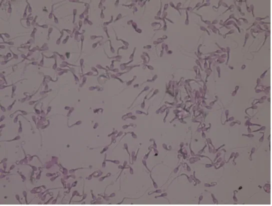 Gambar 3. Spermatozoa kerbau setelah ekuilibrasi. (a) spermatozoa hidup, (b) spermatozoa  mati