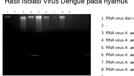 Gambar 1.Elektroferoragram RNA Virus Dengue Lokasi Gadut