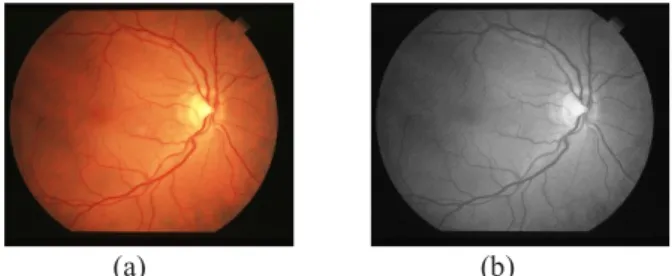 gambar  fundus  retina  yang  digunakan  sehingga  tekstur  pembuluh  retina  dapat  dhilangkan