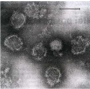 Gambar 5. Rubela virus di bawah mikroskop elektron 