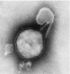 Gambar 2. Parainfluenza virus.8 