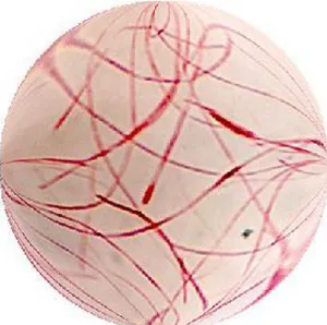 Gambar  2.8  Fusobacterium  nucleatum  (Sumber:  https://health.adelaide.edu.au/dentistry/oral_disease/researc h/fusobact.htm) 