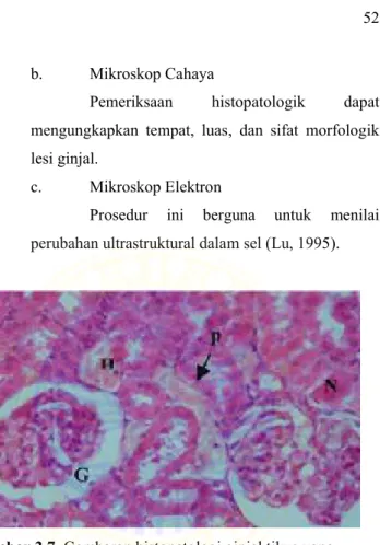 Gambar 2.7. Gambaran histopatologi ginjal tikus yang  mengalami nekrosis (G), piknosis (p), dan  kongesti (H) (El-Maghraby et al, 2010)