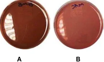 Gambar 1. Contoh media yang belum diinokulasi. A) Media eosin metilen blue, B) Media 