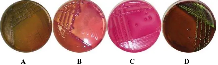 Gambar 7. Beberapa contoh koloni bakteri pada media kultur. A) Pseudomonas aeruginosa pada MacConkey