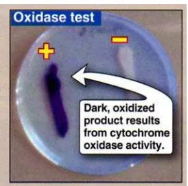 Gambar 10. Tes Oksidase 