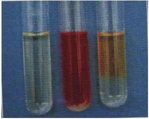 Gambar 13. Tes methyl red, kiri yang belum diinokulasi, tengah methyl red positif, kanan methyl red negatif