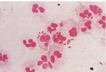 Gambar 3. Bakteri batang gram-negatif pada pemeriksaan mikroskopis urin 