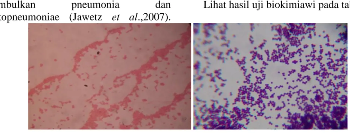 Tabel 4. Hasil Uji Hasil Biokimiawi 