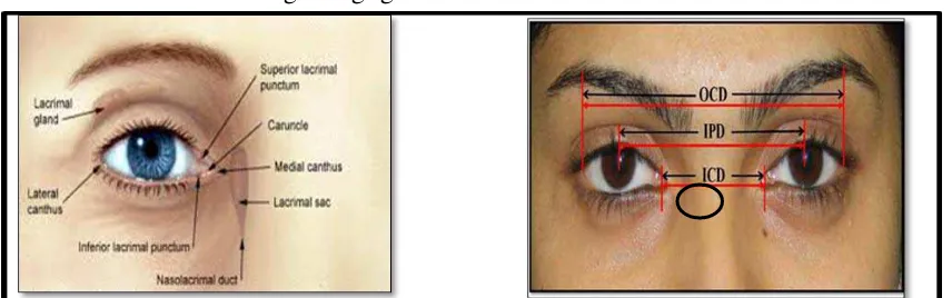 Gambar 6. Anatomi mata dan metode pengukuran jarak interkantal 19 Ket : OCD : Outercanthal distance ; IPD : Interpupillary distance ; ICD :  