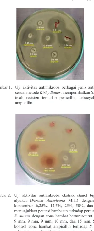 Gambar 1.  Uji aktivitas antimikroba berbagai jenis antibiotika  sesuai metode Kirby Bauer, memperlihatkan S