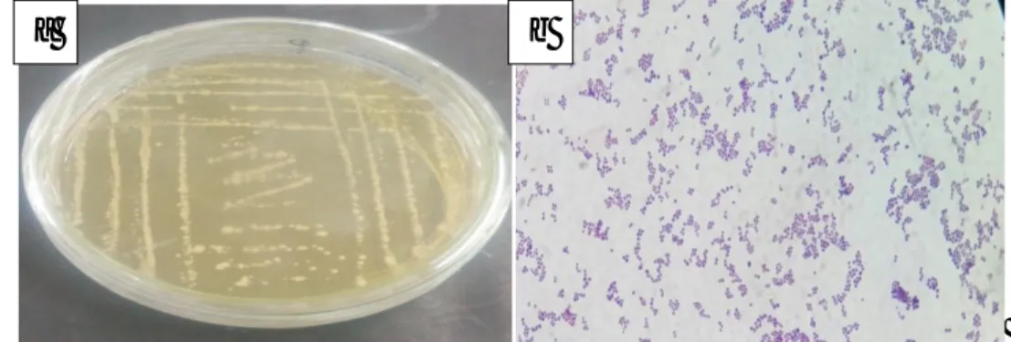 Gambar  morfologi  koloni  dan  hasil  dari  pewarnaan  gram  S. 