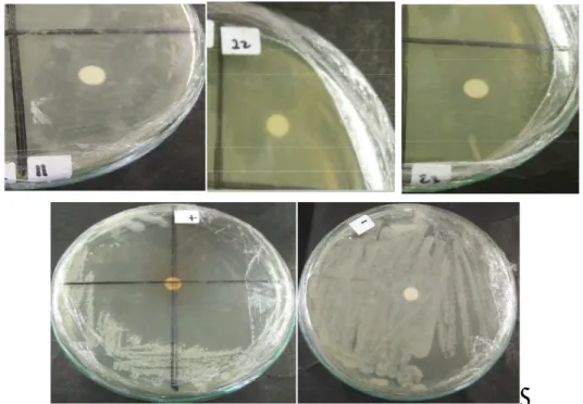 Gambar 3.2 Aktivitas zona hambat bakteri endofit dan kontrol  terhadap S. aureus 